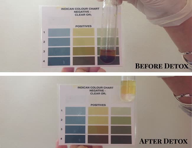 Gut Detox- Before and After Gut Detox- Before and After