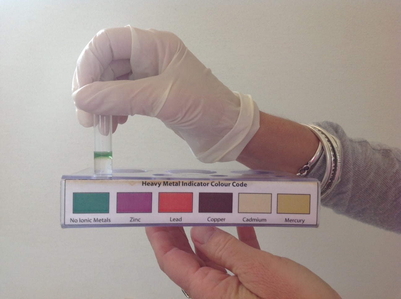 Urine Analysis After Urine Analysis After