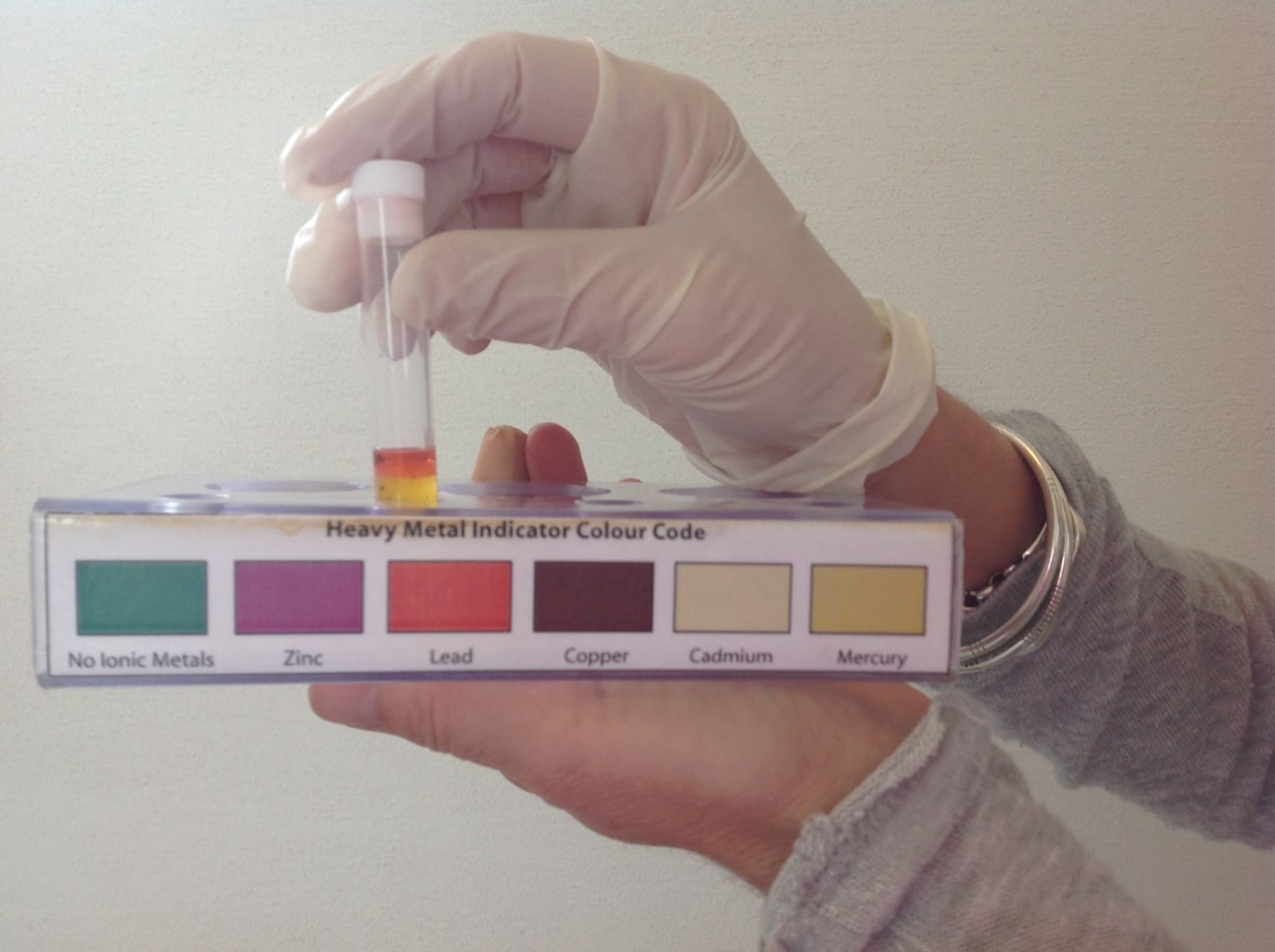 Urine Analysis Before Urine Analysis Before